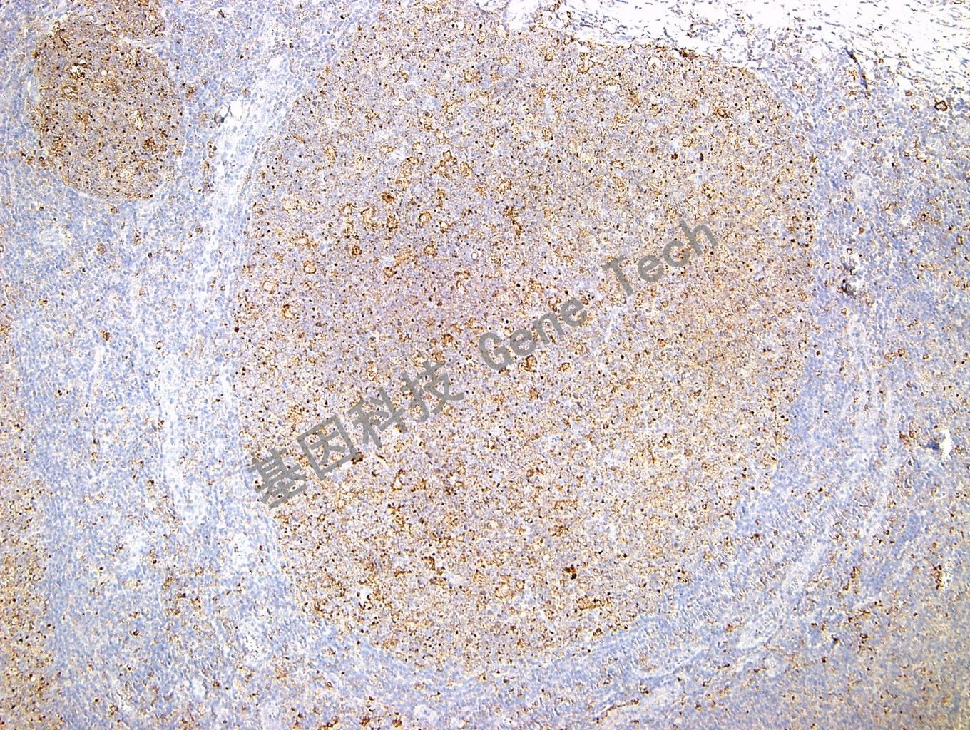 1617871345570918.jpg